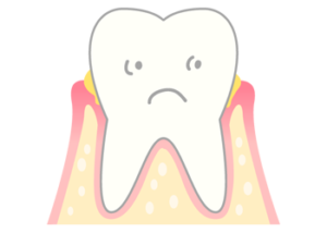 もし、自分の歯を残すことを目指すのであれば、歯周病予防は欠かせません‼️
